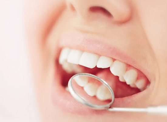 Dental bonding in Queens NY.